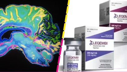 lecanemab, el medicamento para Alzheimer aprobado en EUA en medio de la polémica