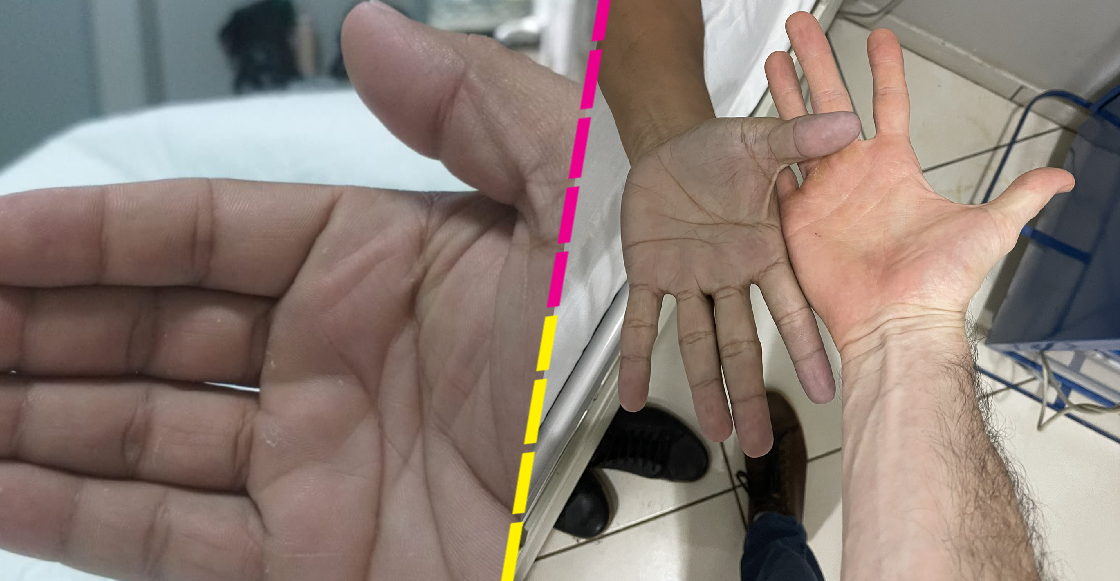 Como cuando terminas asustado en el hospital por culpa de tus pantalones