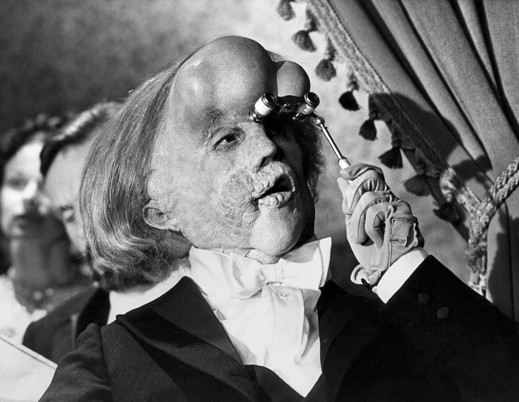 Imagen de 'The Elephant Man' de David Lynch 