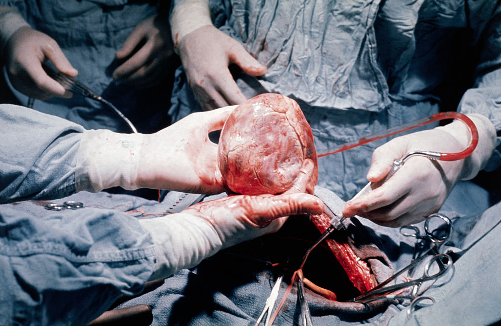 Mujer recibió trasplante de corazón justo el 8M en el IMSS