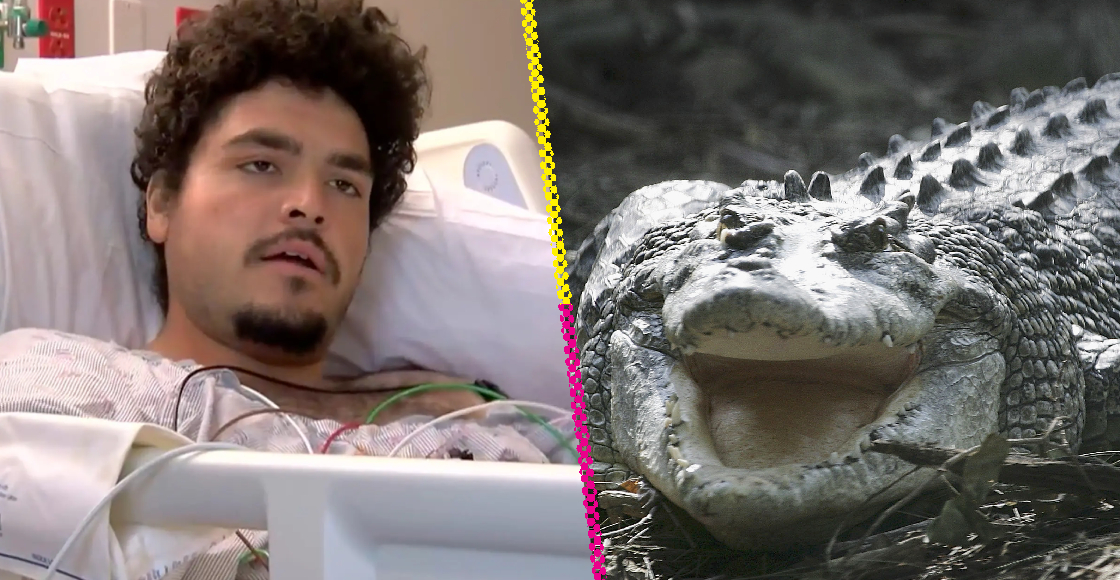 Como cuando te da flojera hacer fila para el baño y un cocodrilo te corta el brazo