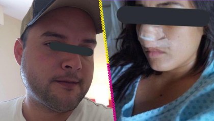 Excandidato en Veracruz volvió a atacar a Jazmín, mujer a quien le arrancó la nariz