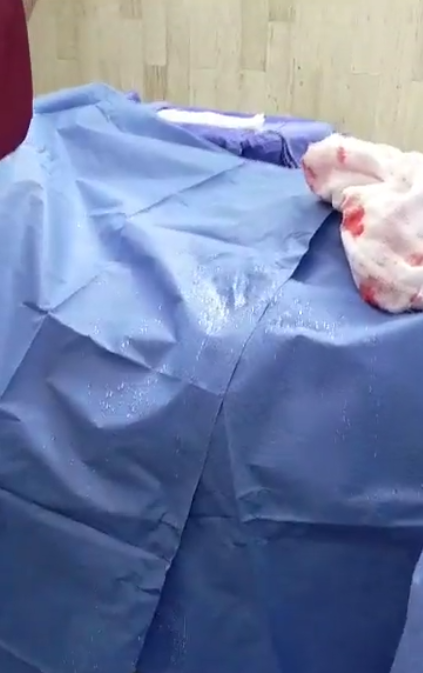 Exhiben gotera que cae sobre paciente durante cirugía en ISSSTE de Chiapas