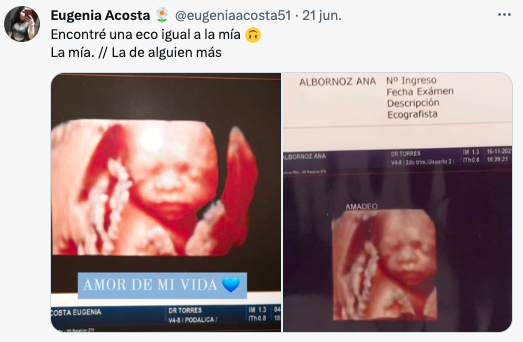 Plop: Mujeres embarazadas denuncian a clínica que les dio la misma ecografía 