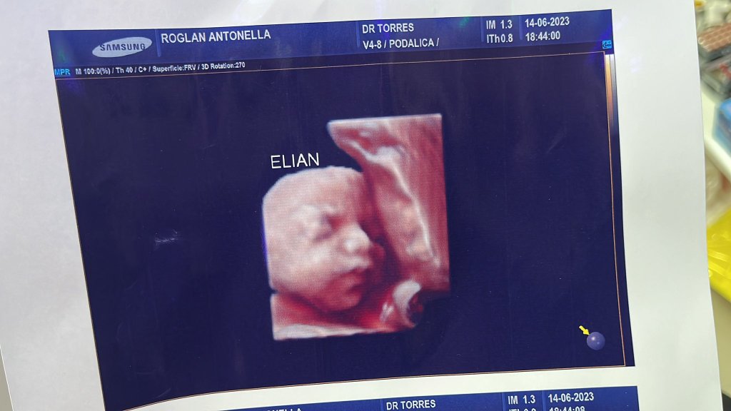 Plop: Mujeres embarazadas denuncian a clínica que les dio la misma ecografía