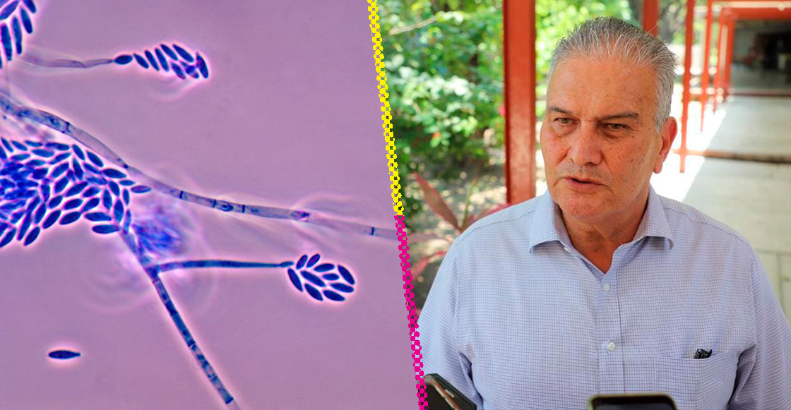 Tamaulipas confirma su primera muerte por brote de hongo Fusarium solani