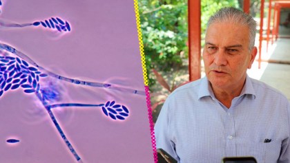 Tamaulipas confirma su primera muerte por brote de hongo Fusarium solani