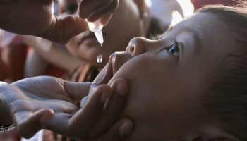 Un niño recibiendo vacuna contra el sarampión.