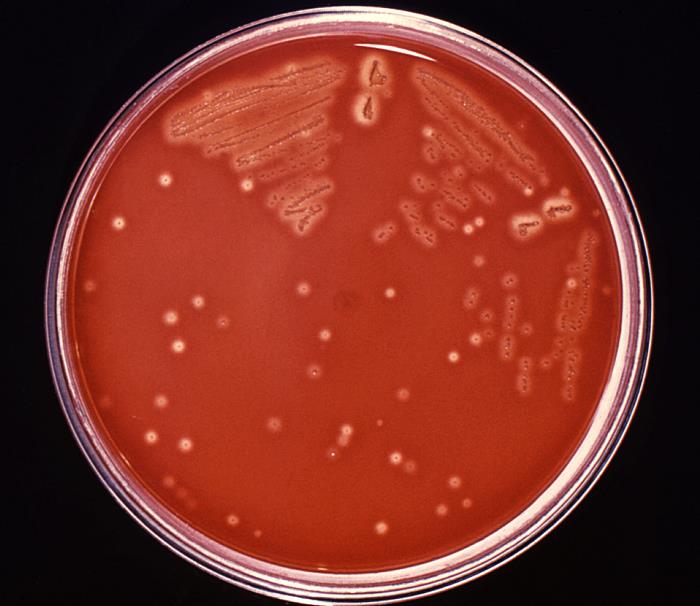 bacteria Streptococcus pyogenes, que cada año infecta a millones de personas
