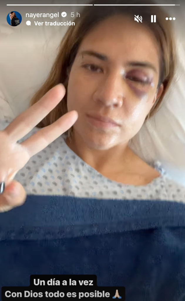 Nayeli Rangel tras cirugía