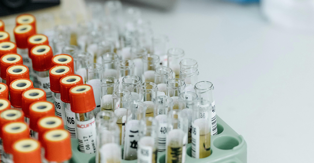 Médicos curan de rara enfermedad a un bebé modificando su ADN