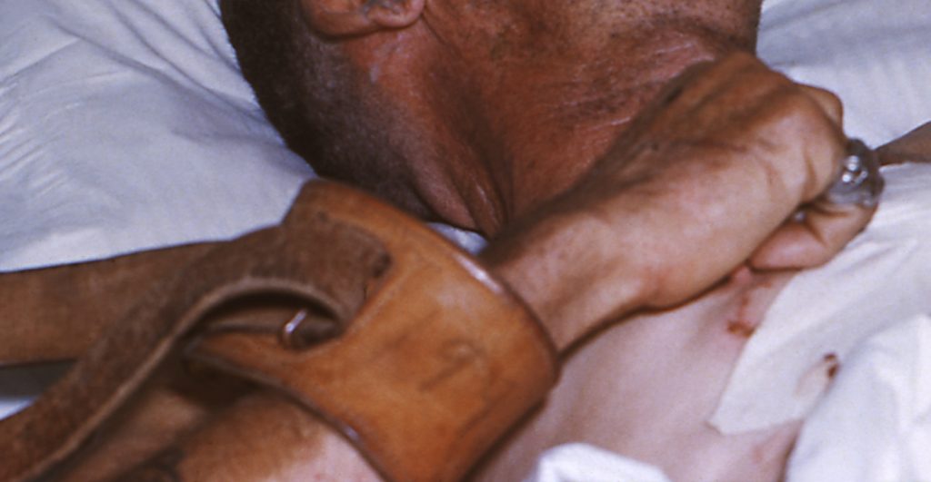 Muere otro hombre contagiado de rabia, ahora en Colima