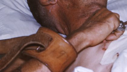 Muere otro hombre contagiado de rabia, ahora en Colima