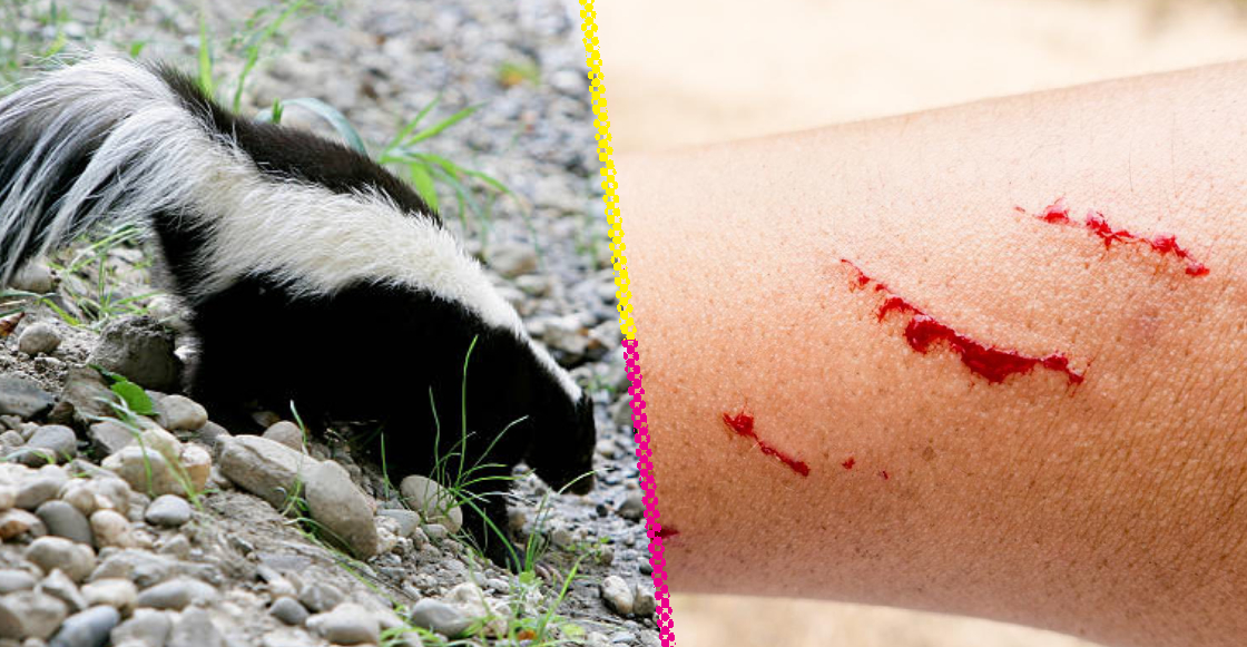 zacatecas-registra-primer-caso-rabia-en-casi-40-anos