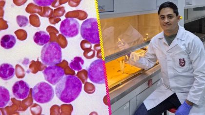 investigadores-ipn-desarrollan-prueba-rapida-detectar-leucemia-infantil
