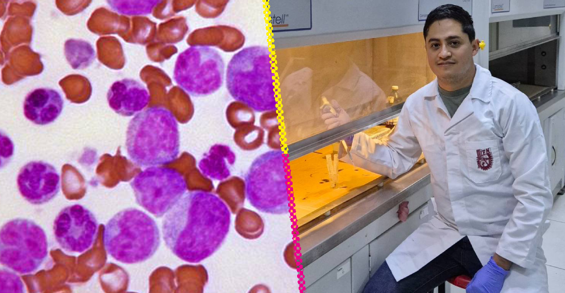 investigadores-ipn-desarrollan-prueba-rapida-detectar-leucemia-infantil