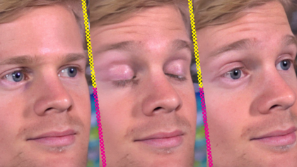 De ser un meme a recaudar fondos para la investigación de la esclerosis múltiple