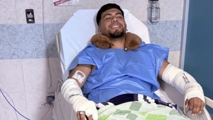 "Una nueva oportunidad de seguir viviendo": Luis, sobreviviente de la explosión en Iztapalapa