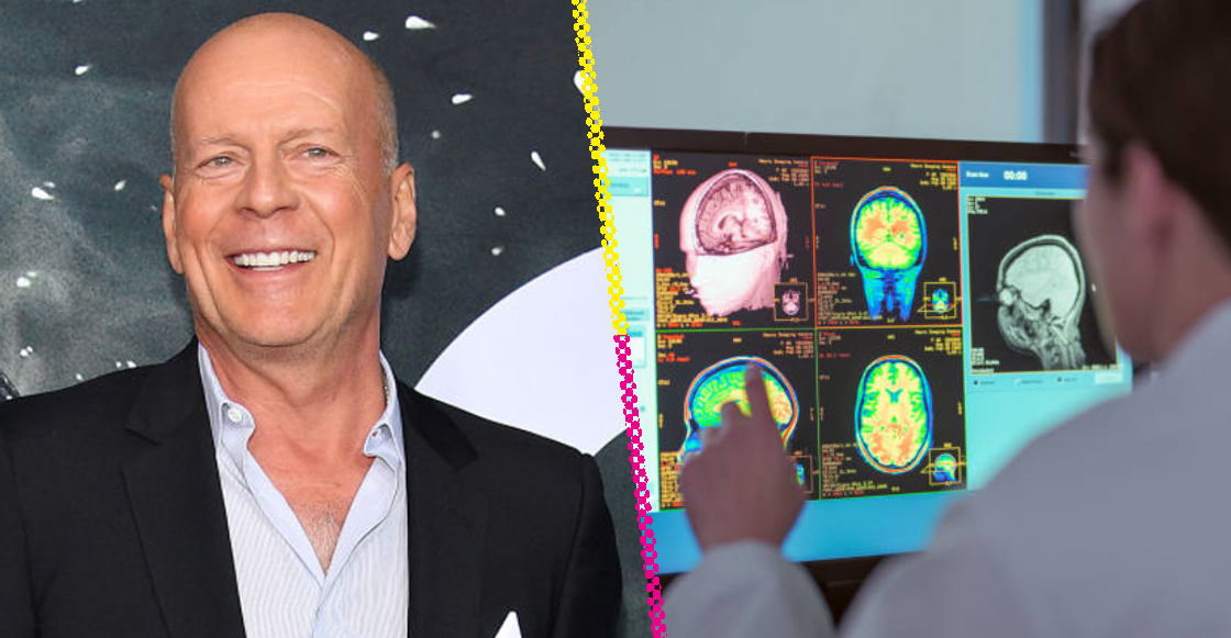 familia-bruce-willis-donara-cerebro-actor-destacada