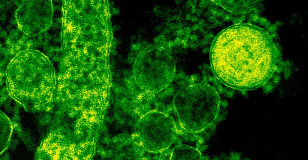 alerta-india-nuevo-brote-nipah-virus-sin-cura-mortalidad-muy-alta-1