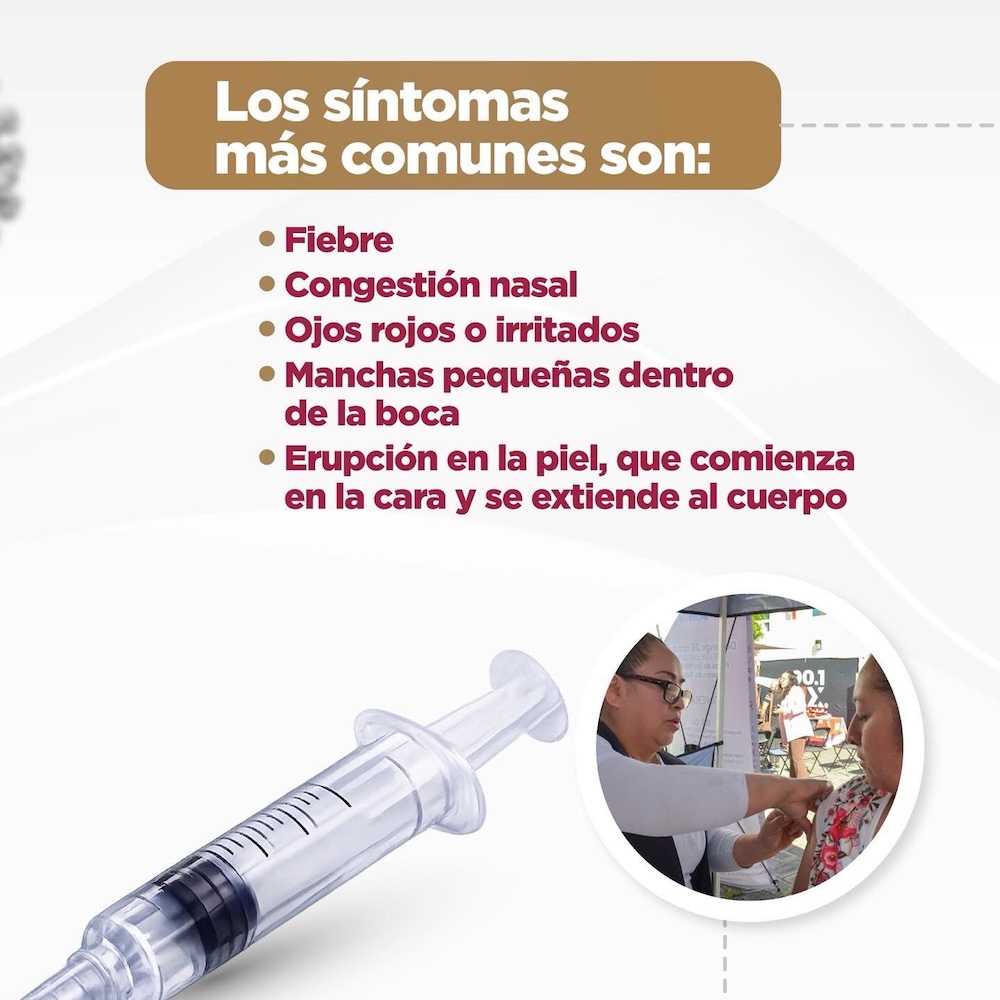 Regreso del sarampión en México: 1.5 millones de niños sin vacuna antes del COVID
