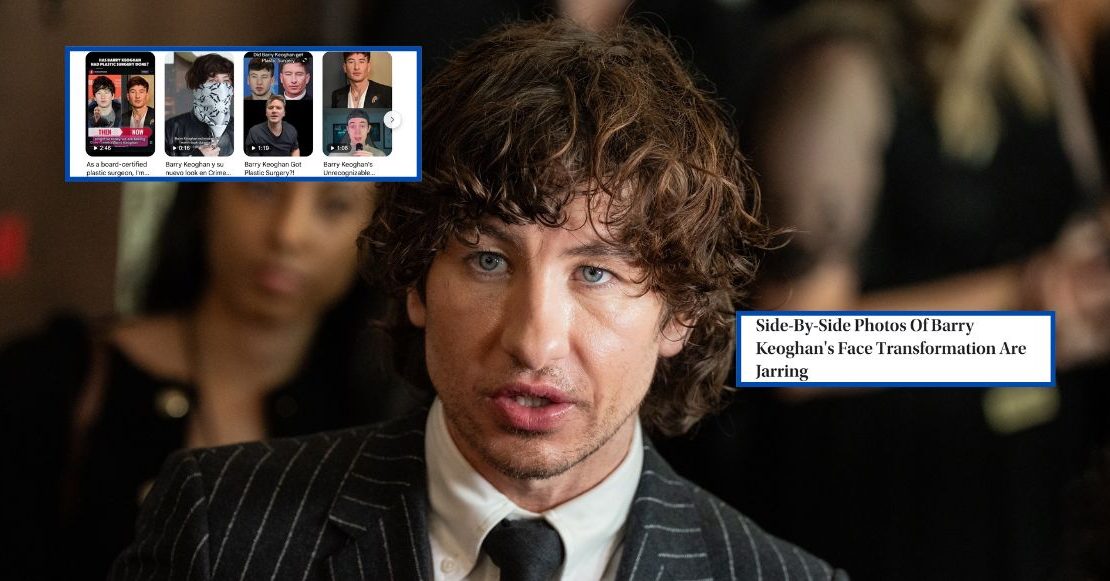 ¿Qué está pasando con Barry Keoghan y el acoso en internet por su apariencia?