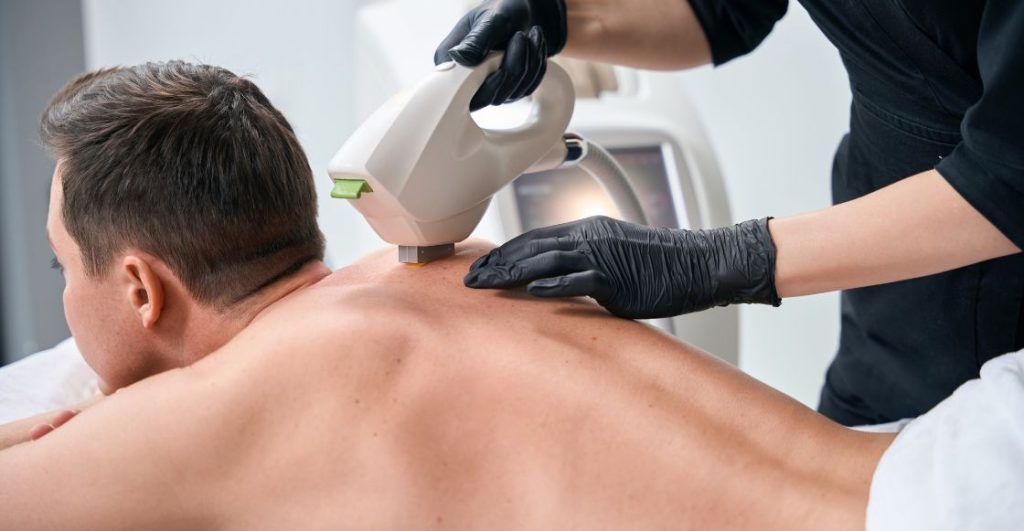 Depilación láser para remover vello del cuerpo