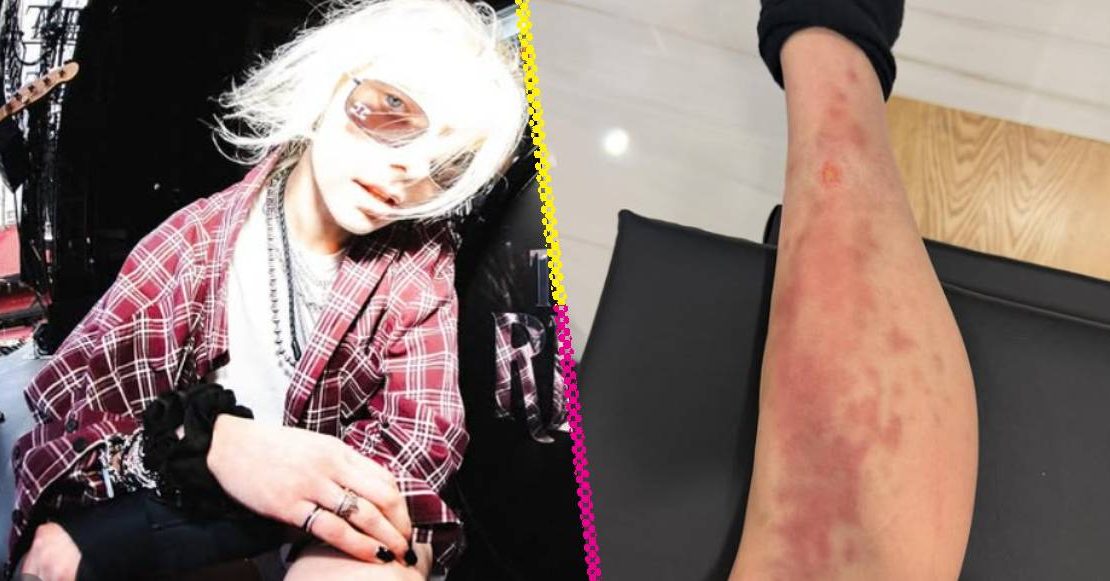 Hospitalizan a Taylor Momsen por picadura de araña antes de concierto de AC/DC