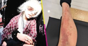 Hospitalizan a Taylor Momsen por picadura de araña antes de concierto de AC/DC