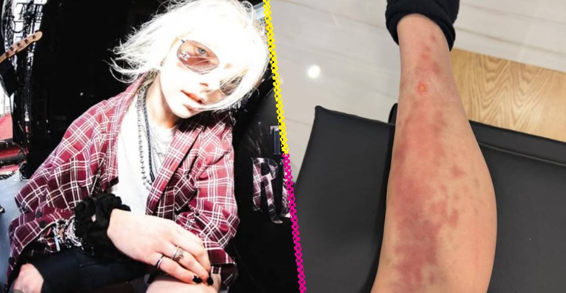 Hospitalizan a Taylor Momsen por picadura de araña antes de concierto de AC/DC