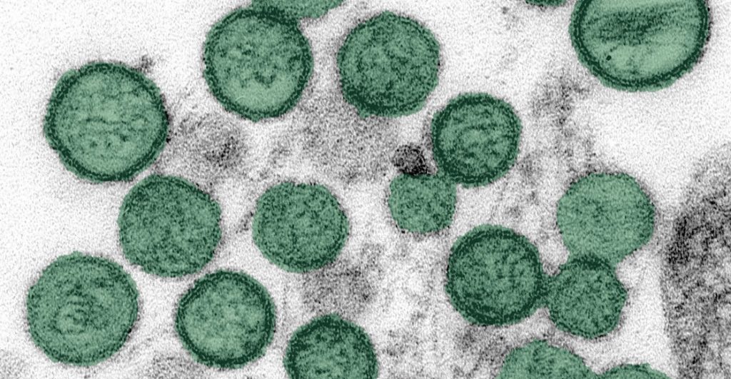 Hantavirus: OMS cree que transmisión fue de persona a persona fuera del crucero