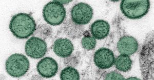 Hantavirus: OMS cree que transmisión fue de persona a persona fuera del crucero