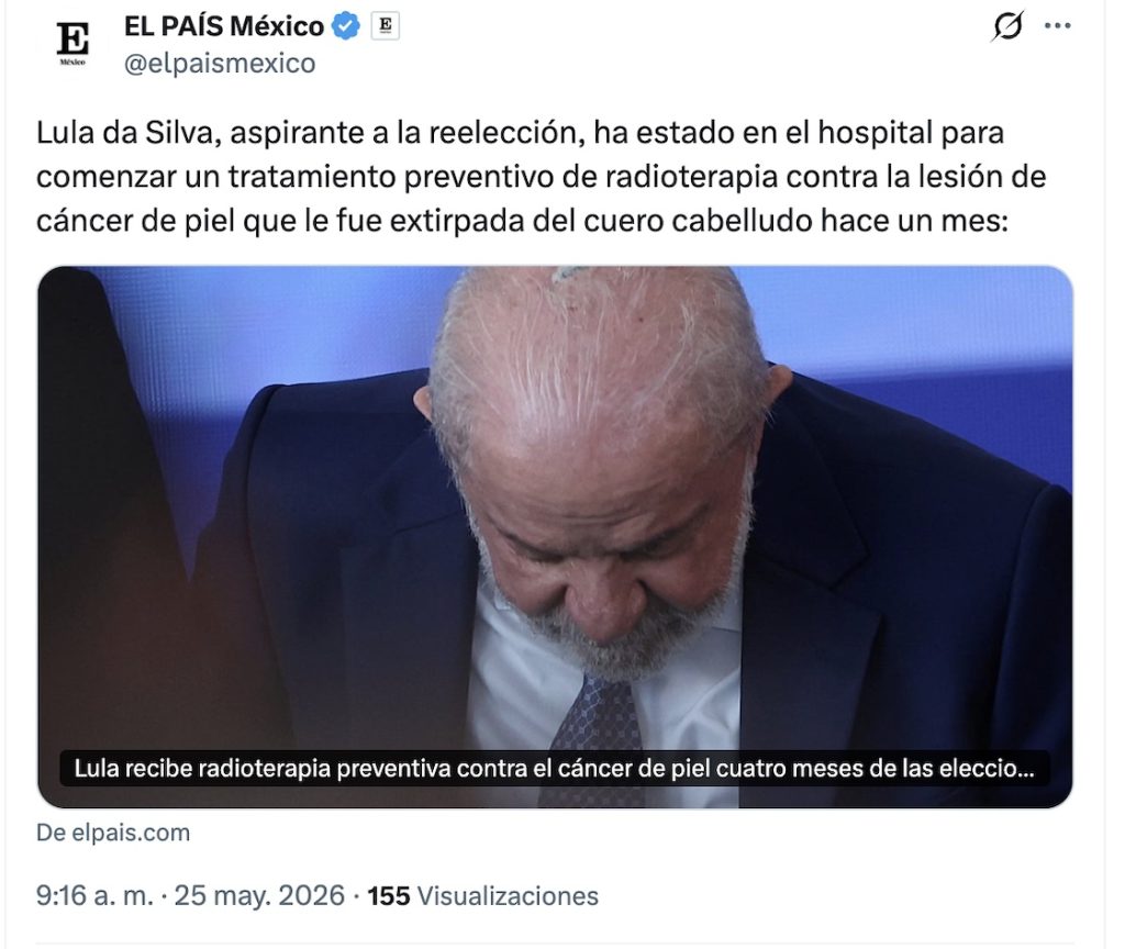 Lula da Silva inicia radioterapia tras diagnóstico de cáncer de piel