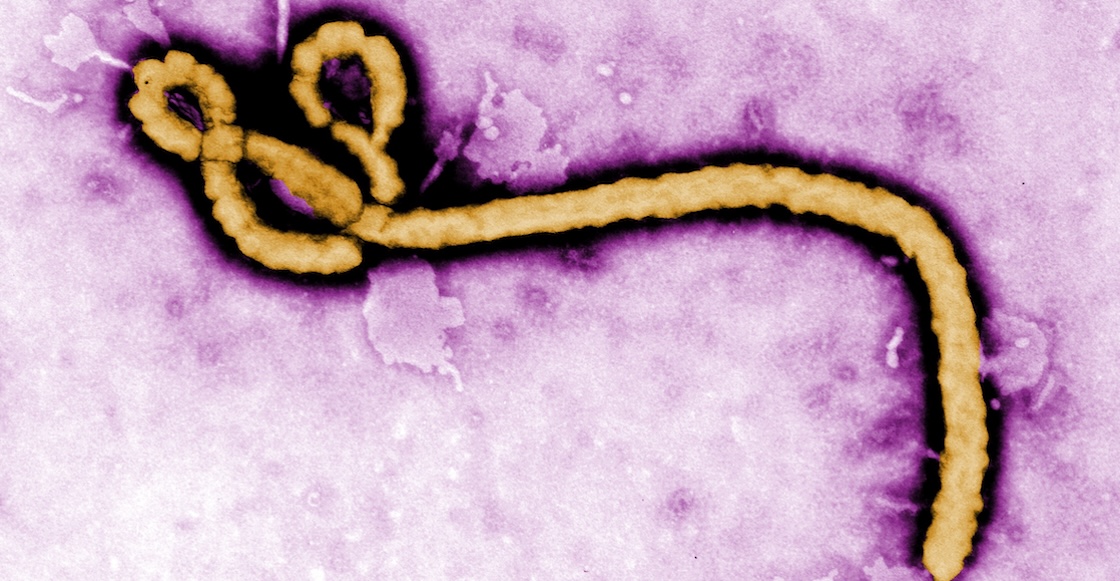 OMS dice que el riesgo de la epidemia de ébola en el mundo es bajo
