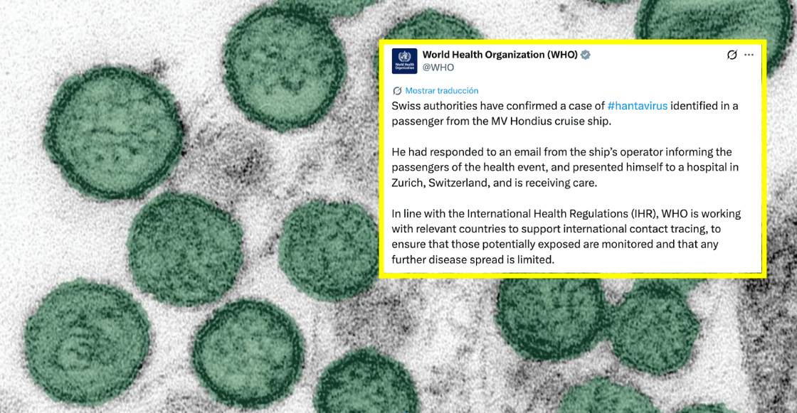 OMS confirma caso de hantavirus en Suiza