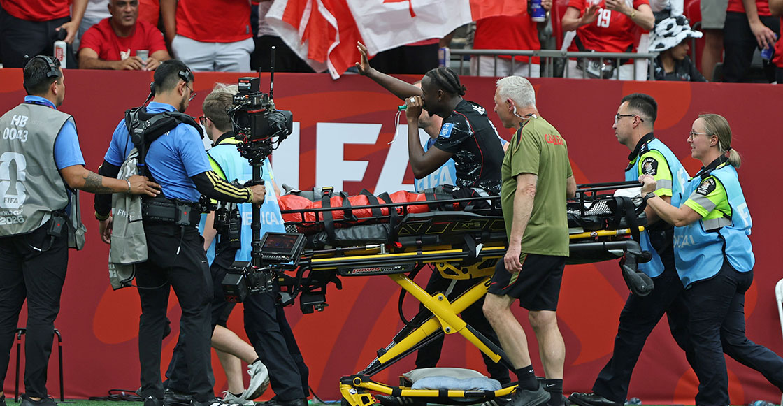 Ismael Kone sufrió fractura de tibia y peroné