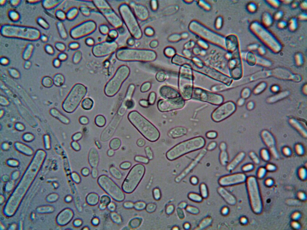 Bacteria "come carne": ¿Qué es, cómo se contrae y cuáles son los síntomas?