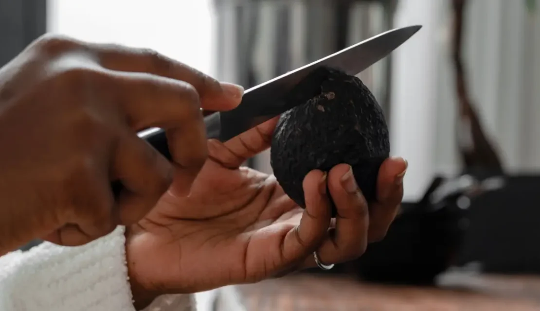 Alemania vs. Guacamole: Aumentan las visitas a urgencias por la “mano de aguacate”