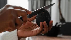 Alemania vs. Guacamole: Aumentan las visitas a urgencias por la “mano de aguacate"