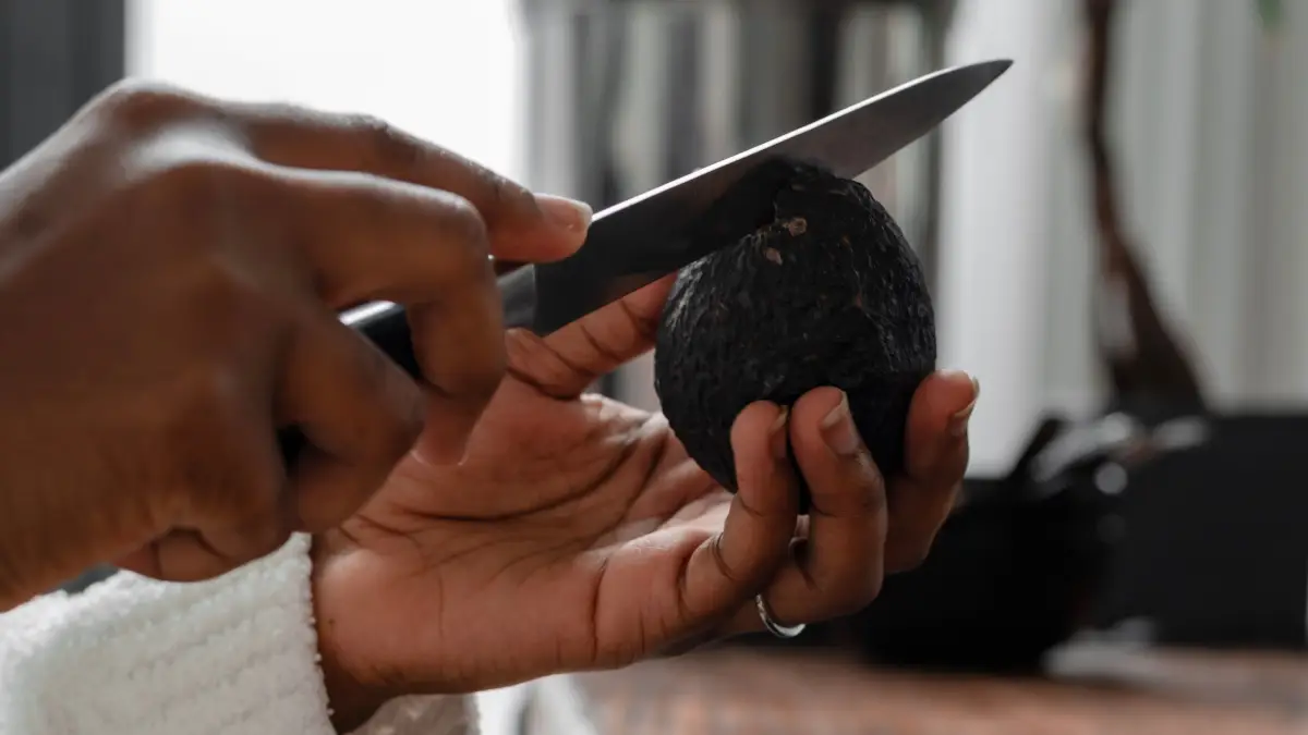 Alemania vs. Guacamole: Aumentan las visitas a urgencias por la “mano de aguacate"